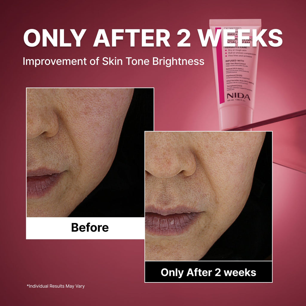 NIDA Youthful Formula™ Yam Mucin  ABCE Facial Cream