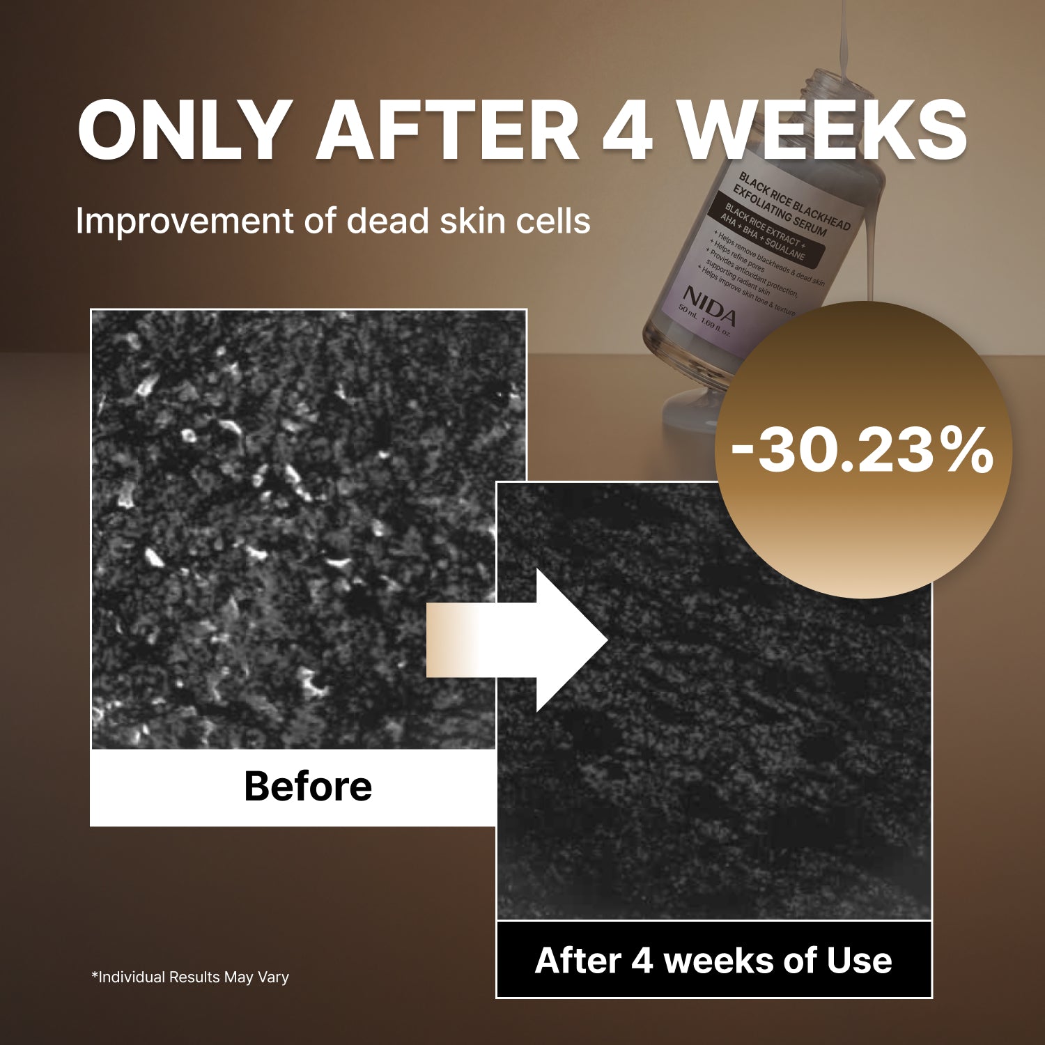 NIDA Black Rice Blackhead Exfoliating Serum