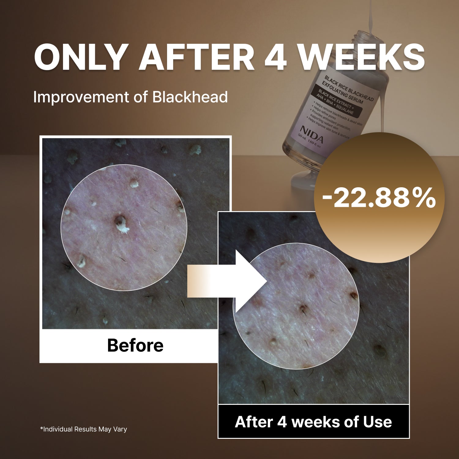 NIDA Black Rice Blackhead Exfoliating Serum