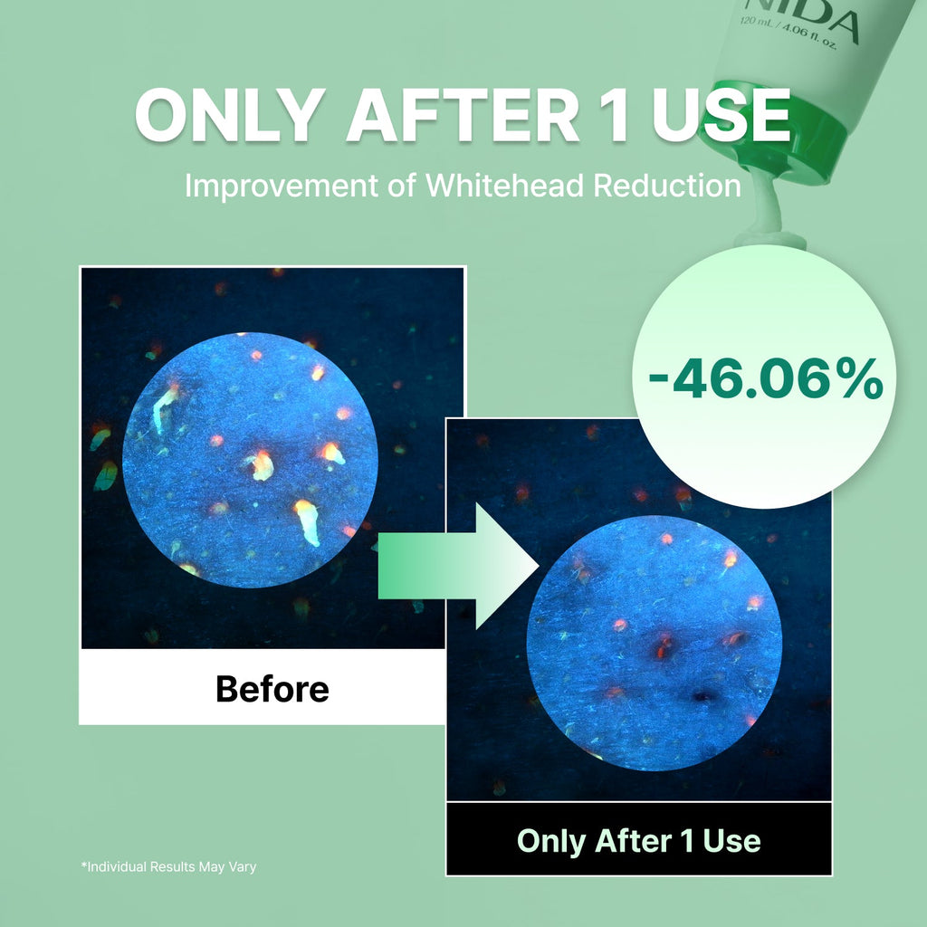 NIDA Centella Deep Pore Cleansing Foam