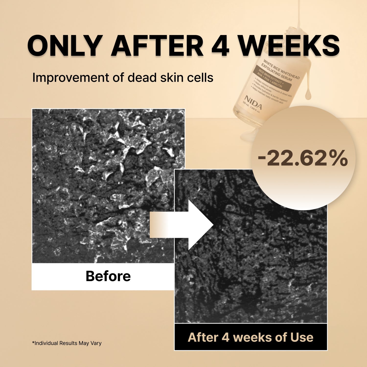 NIDA White Black Exfoliating Serum Duo Bundle