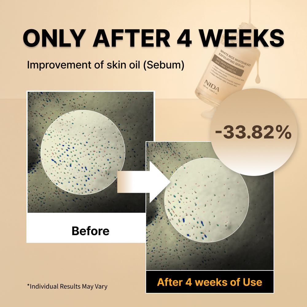 NIDA White Rice Whitehead Exfoliating Serum
