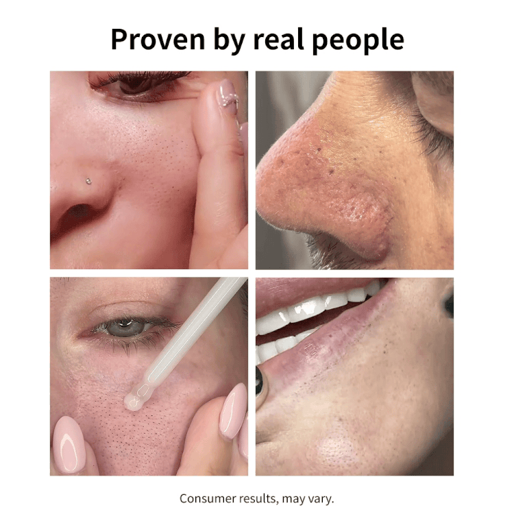 NIDA Black Rice Blackhead Exfoliating Serum